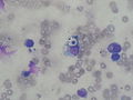 Cryptococcus smear MGG 2010-01-26.JPG